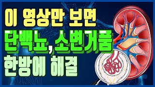 단백뇨, 소변거품 원인, 증상, 치료 완치에 도움되는 방법(음식, 지압 )/ 소변에 거품이나는이유, 없애는 법 [하늘건강법]