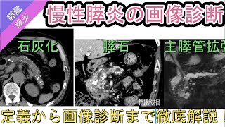 慢性膵炎の画像診断