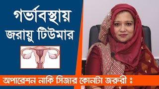 গর্ভাবস্থায় যদি জরায়ু টিউমার হয় বাচ্চার কি হবে ? জরায়ু টিউমারের লক্ষণ ও চিকিৎসা | Uterus fibroid