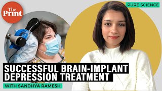 How clinical depression is being successfully treated through implant