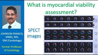 What is myocardial viability assessment?