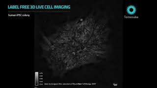 Human induced pluripotent stem cells (iPSCs) - Label free 3D Live cell Imaging taken by the HT_X1