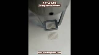 여드름흉터 어븀야그 프락셀 레이저 Er-Yag Fractional laser for acne scar #shorts