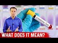 Causes of High Creatinine Levels in Blood – Dr.Berg on Elevated Creatinine Levels