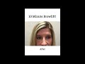 dr. kristina tansavatdi brow lift in 10 minutes