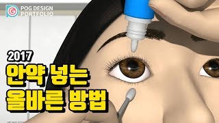 안약 넣는 올바른 방법