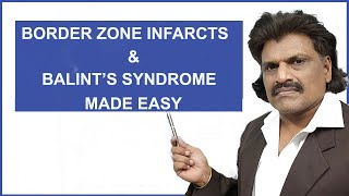 BORDER ZONE INFARCTS \u0026 BALINT'S SYNDROME MADE EASY