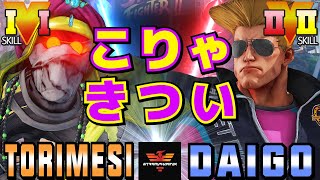 ストリートファイター５✨鶏めし [ダルシム] Vs ウメハラ [ガイル] こりゃきつい | SFV CE✨Torimesi [Dhalsim] Vs Daigo Umehara [Guile]✨スト５