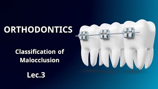 Orthodontics Classification of Malocclusion - تقويم الاسنان المحاضرة الثالثة