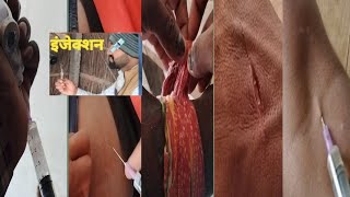 mini injection vlog video /village injection video #injection#hospital#crying#health#injection_funny