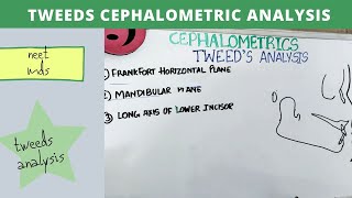tweeds cephalometric analysis - orthodontics lecture notes