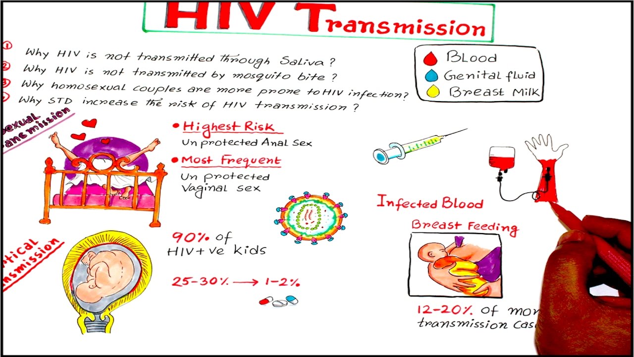 Hiv Aids Transmission Methods