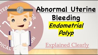 Abnormal Uterine Bleeding Series - Endometrial Polyp