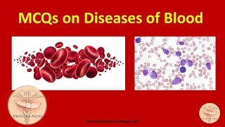 MCQs on Diseases of Blood - RBC disorders, WBC disorders, Bleeding and clotting disorders