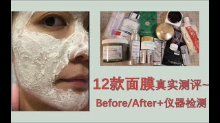 12款自用面膜真实无滤镜无PS最近近近近距离测评分享｜Before After｜皮肤检测仪