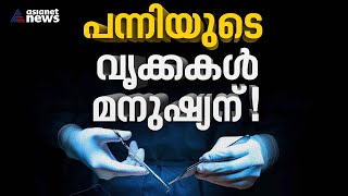 ജനിതക മാറ്റം വരുത്തിയ പന്നിയുടെ വൃക്ക മനുഷ്യനില്‍ വച്ചുപിടിപ്പിച്ചു | Pig kidney | Human body