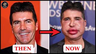 Top 10 Celebrity Plastic Surgery Nightmares: When Beauty Turns Into A Disaster | Then and Now 2026