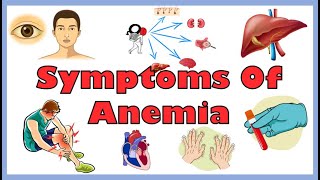 Common Signs & Symptoms Of Anemia |Iron Deficiency, Hemolytic & Other Anemias | Anemia Symptoms