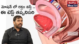What is Diverticulosis ? Colonoscopy Procedure and Its Use | Dr.Krishna Chowdary @MedPlusONETV