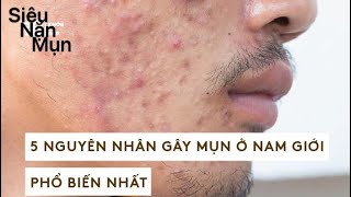 Seri Nặn Mụn-Part 37 Đi tìm nhân mụn siêu khủng