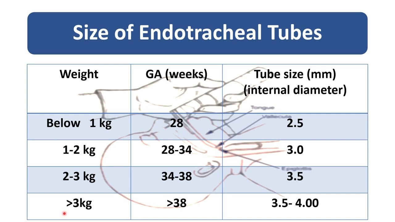 Endotracheal Intubation Pediatrics Youtube