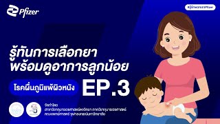 โรคผื่นภูมิแพ้ผิวหนัง EP.3 - รู้ทันการเลือกยา พร้อมดูอาการลูกน้อย