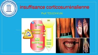 insuffisance corticosurrénalienne (ICS) បង្រៀនដោយលោកគ្រូសាស្ត្រាចារ្យ TOUCH KUN