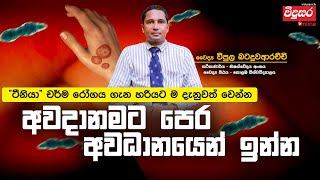 මොකක්ද මේ ටීනියා දිලීර රෝගය? | අවදානමට පෙර අවධානයෙන් සිටින්න #tinea #virus #vidusara