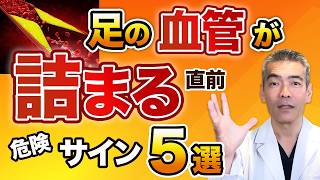 足の血管が詰まる直前の危険サイン5選・足の動脈硬化を予防する食事とは？