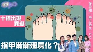 健康關注組 ｜ 十指出現異變，指甲漸漸殭屍化？ ｜ HOY TV 77台 ｜ 郭田葰 ｜ 黃芳雯 ｜ 林曉蕙 ｜ 第45集