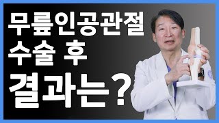 무릎인공관절수술이 가장 성공적인 수술법 중 하나라고 불리는 이유