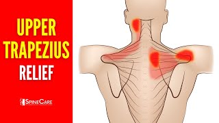 How to INSTANTLY Fix Upper Trapezius Pain