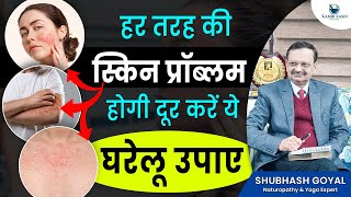 हर तरह की स्किन प्रॉब्लम होगी दूर, करें ये घरेलू उपाय | 3 Natural Skincare Remedies| Subhash Goyal