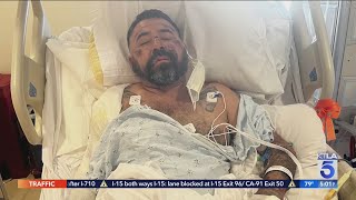 Scooter rider severely injured in hit-and-run crash