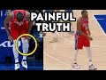 Is Joel Embiid's Knee Finished? Doctor Explains