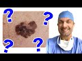 Melanoma Review for the ABSITE - Questions and Answers