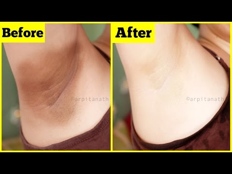 Whiten Dark Underarms Instantly | Remove Unwanted Body Hair | 100% Natural Whiten Dark Underarms Instantly | Remove Unwanted Body Hair | 100% Natural