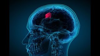 Brain Tumor Image Segmentation using Python and OpenCV