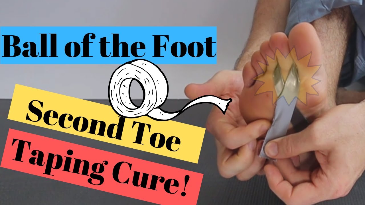 2nd Toe Pain Capsulitis & Ball Of Foot Taping [BEST Home Treatment ...