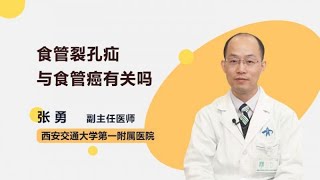 食管裂孔疝与食管癌有关吗 张勇 西安交通大学第一附属医院