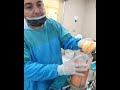 dr.bəxtiyar qəhrəmanovun icra etdiyi liposaksiya əməliyyatının sarı piydən ibarət nəticəsi