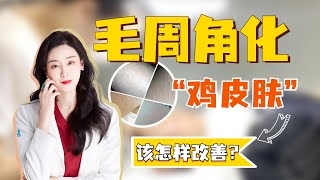 毛周角化该怎样改善？【皮肤科刘小娇医生】