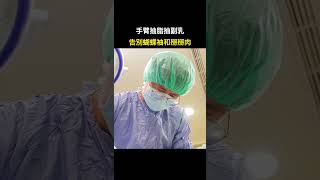 女孩透過手臂抽脂改善蝴蝶袖掰掰肉困擾 台中教主醫美整形 Dr.林仲樵醫師