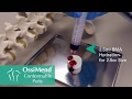 Collagen Matrix - Orthopaedic OssiMend® Conformable Putty - Product Demo