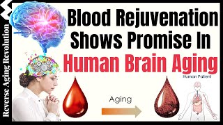 Blood Rejuvenation Shows Promise In Human Brain Aging