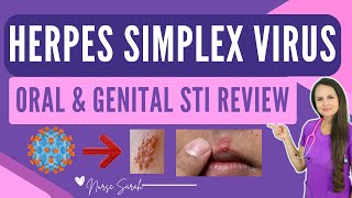 Herpes Simplex Virus (HSV-1 & 2) Nursing STI NCLEX Review | Oral and Genital Herpes