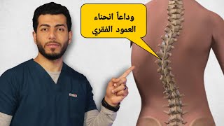 كيفيه التخلص من الجنف او انحناء الظهر الجانبى |٤تمارين لعلاج انحناء العمود الفقري