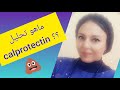 تحليل calprotectin من عينة البراز 🤥