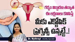 ఎక్టోపిక్ ప్రెగ్నెన్సీ లక్షణాలు || Ectopic Pregnancy Signs \u0026 Symptoms in Telugu || Dr Mythrayi