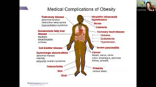 5/12/2023: Challenges with Obesity with Chronic Disease in the Population